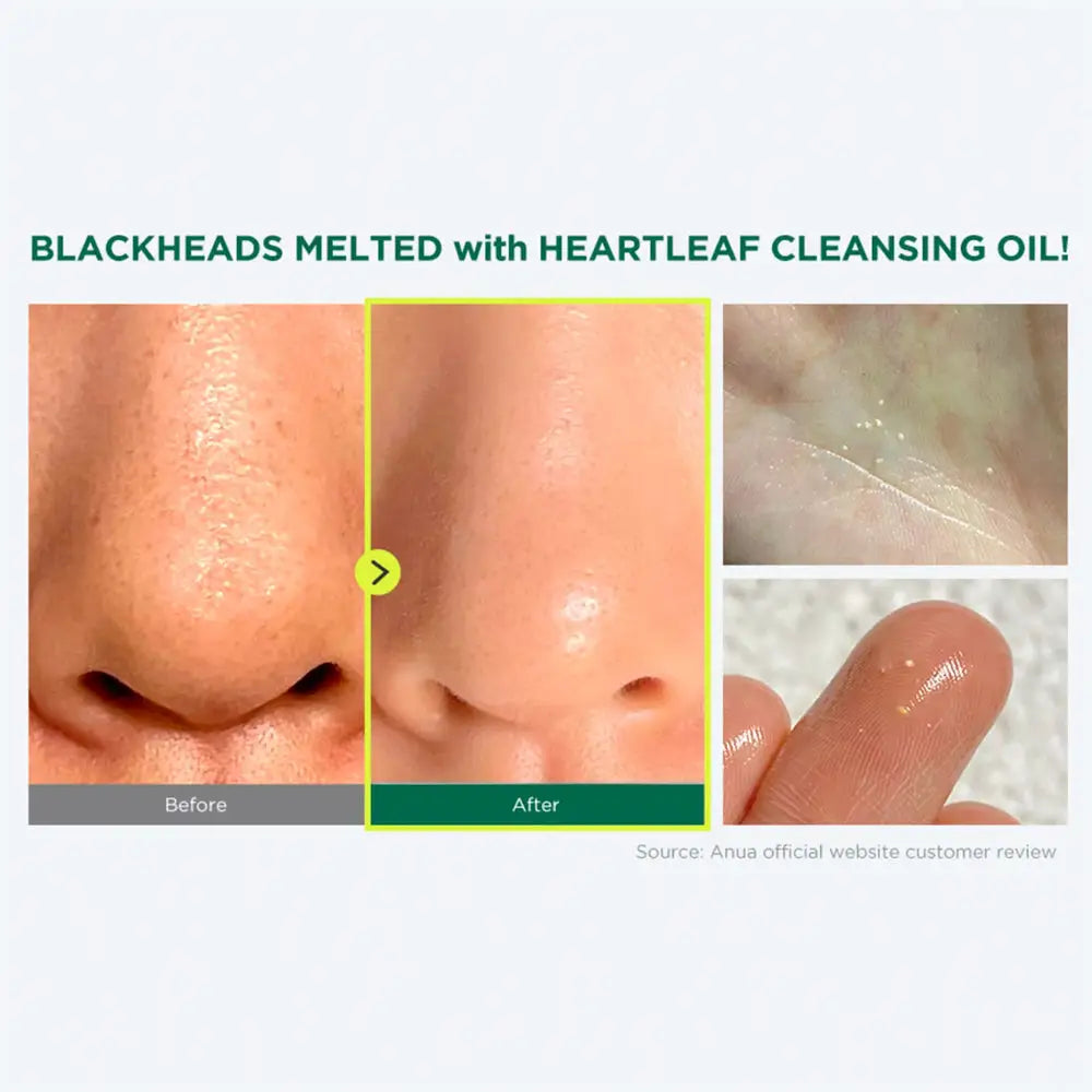 ANUA Heartleaf Pore Control Cleansing Oil MINI 20ml masques