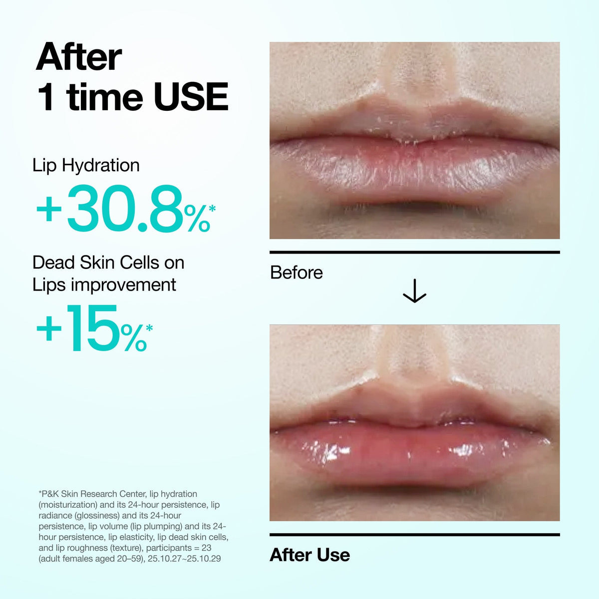 ANUA -PDRN Lip Serum - 10ml