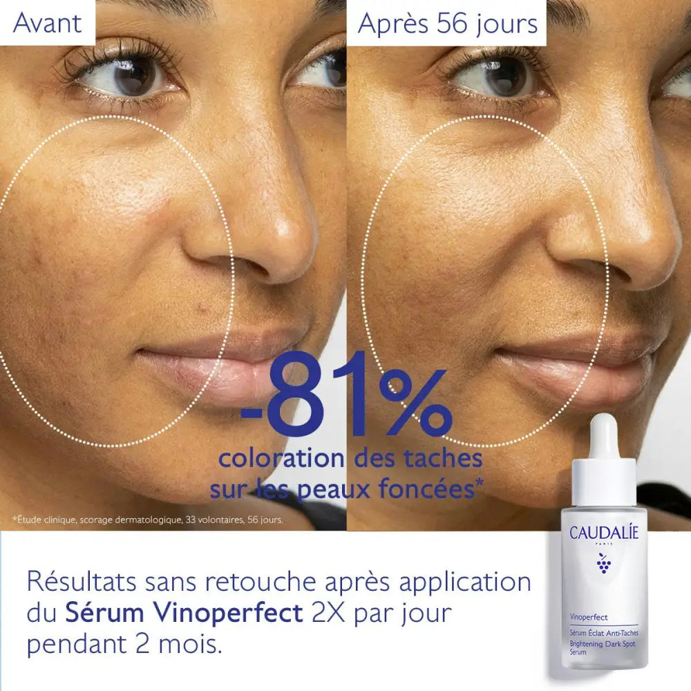 CAUDALIE New Vinoperfect Sérum Éclat Anti Taches 30ml