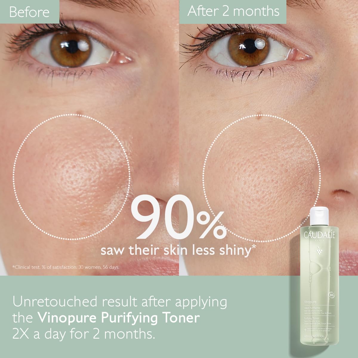 CAUDALIE - Vinopure
Lotion Purifiante à l'Acide Salicylique - 200ml
