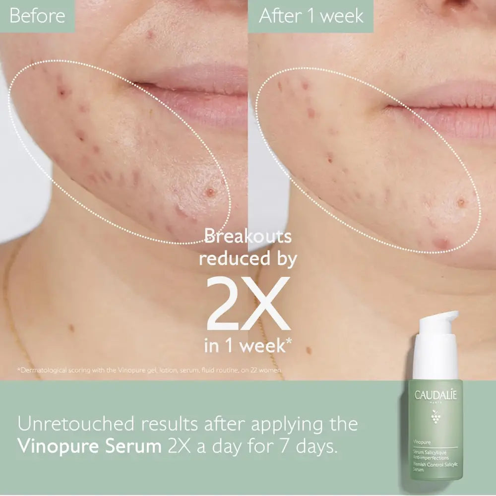 CAUDALIE Vinopure Sérum salicylique anti imperfections 30ml