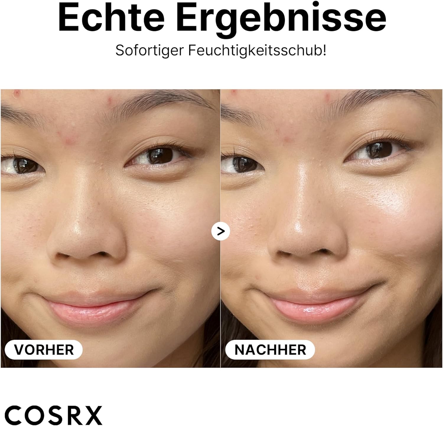 COSRX - The Hyaluronic Acid 3 - 20ml