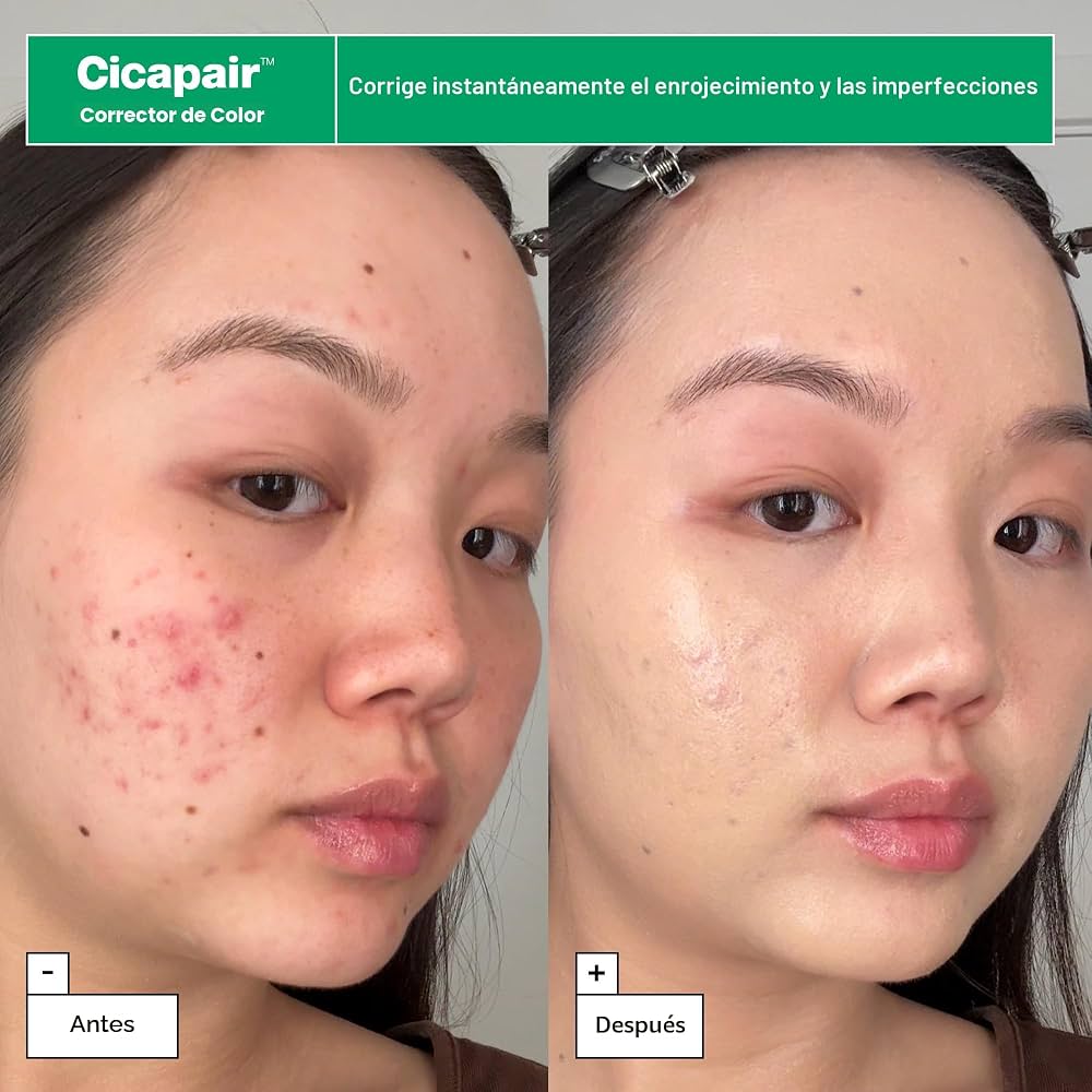 DR.JART+ - Cicapair Coffret Routine Rescue Anti-Rougeurs à la Centella Asiatica