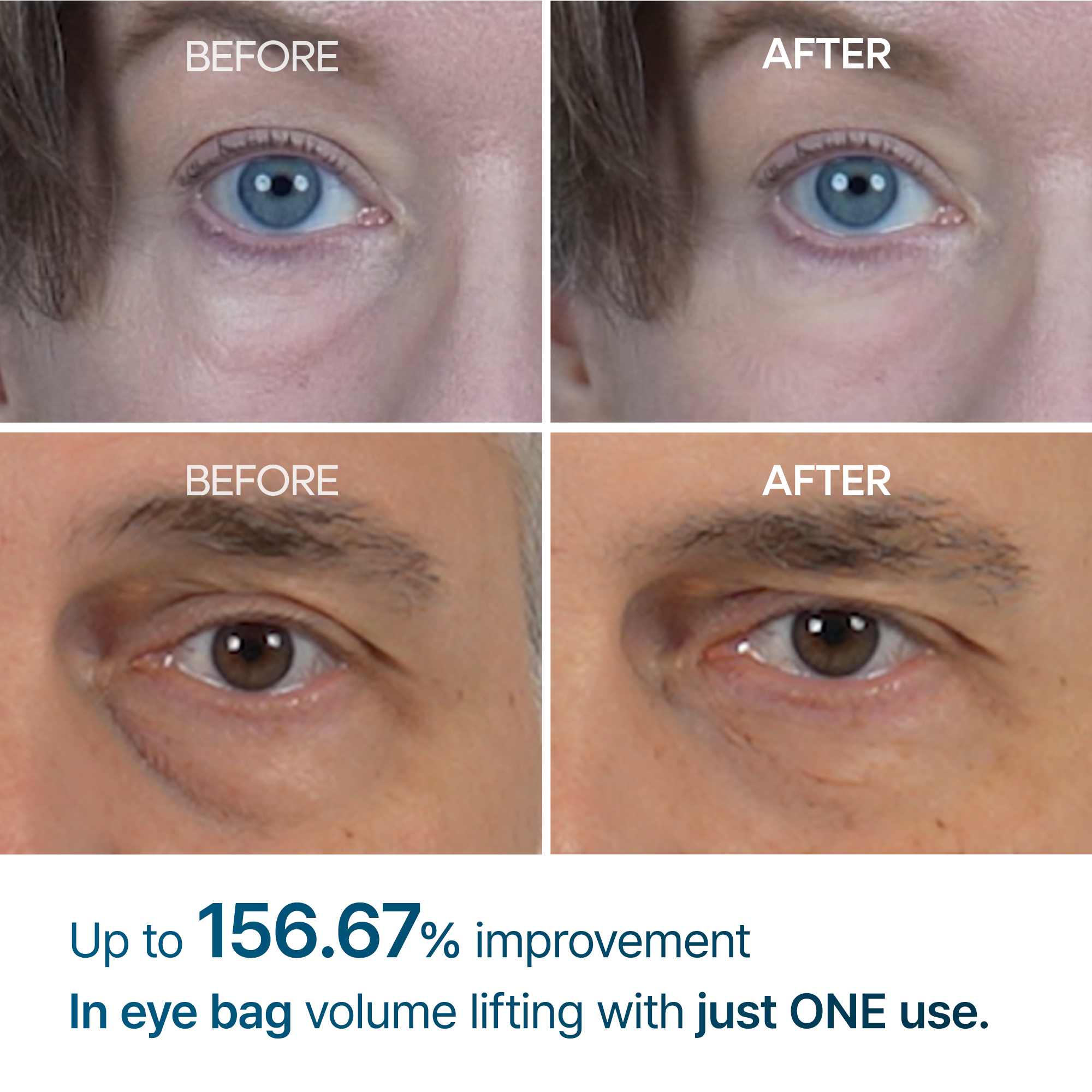 Dr MELAXIN - Eyephalt Eyebag Cream - 10g