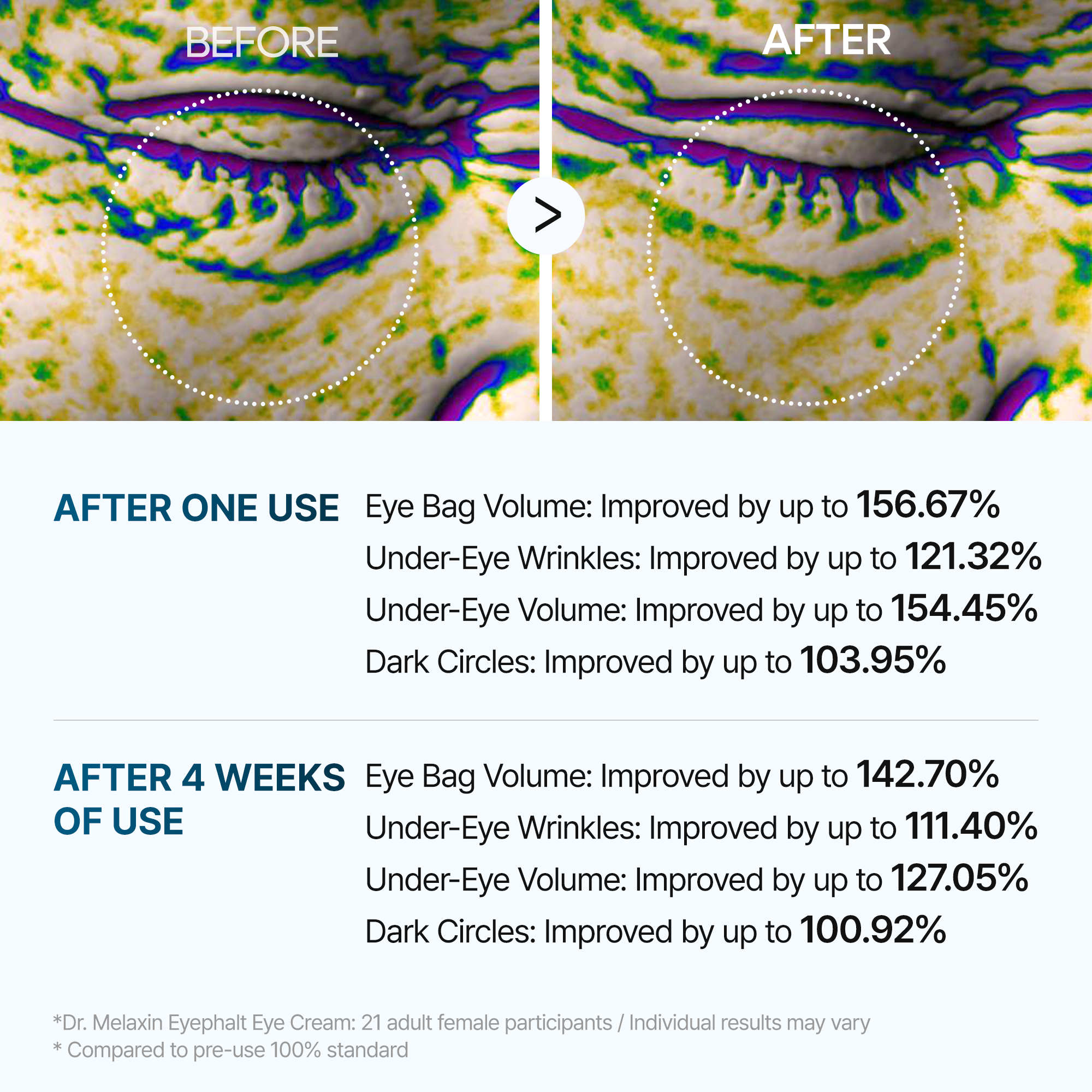 Dr MELAXIN - Eyephalt Eyebag Cream - 10g