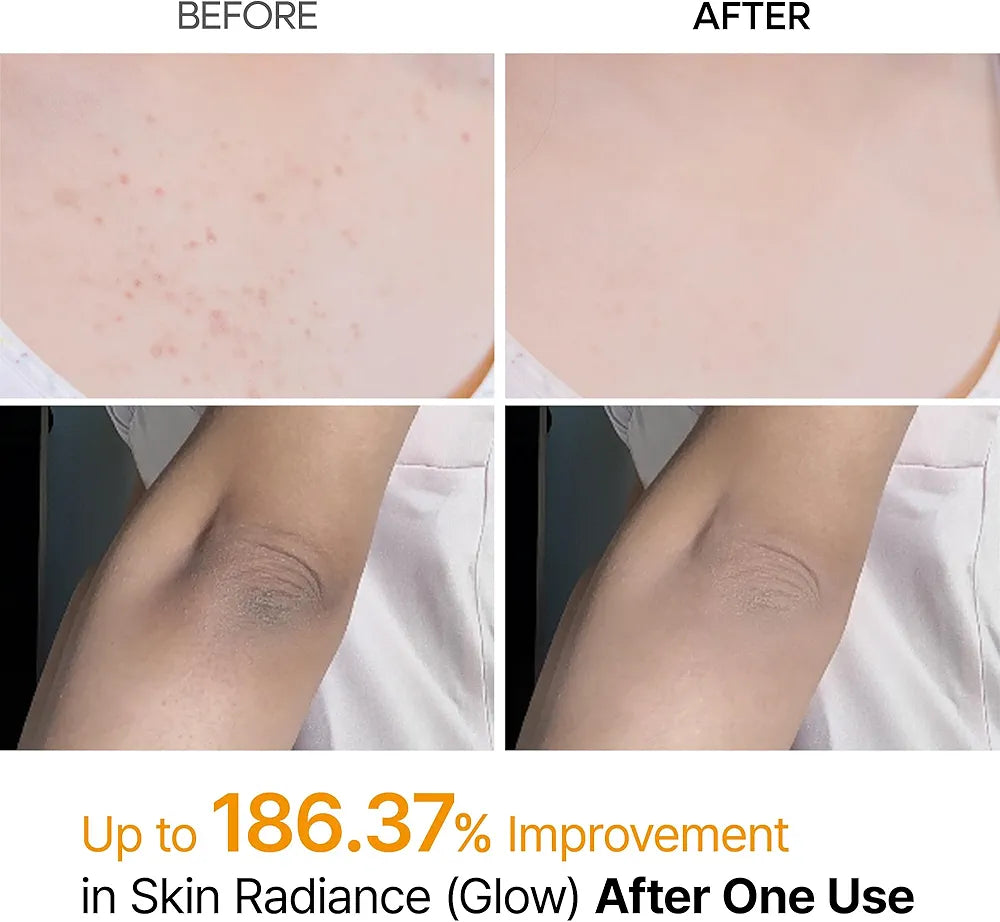 Dr MELAXIN - Peel Shot Exfoliating Kojic Acid Turmeric Spray - 200 ml