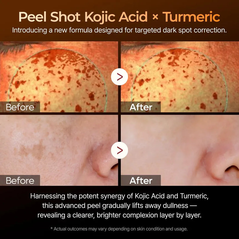 Dr MELAXIN - Peel Shot Kojic Acid & Turmeric Facial Exfoliating Serum – 80ml