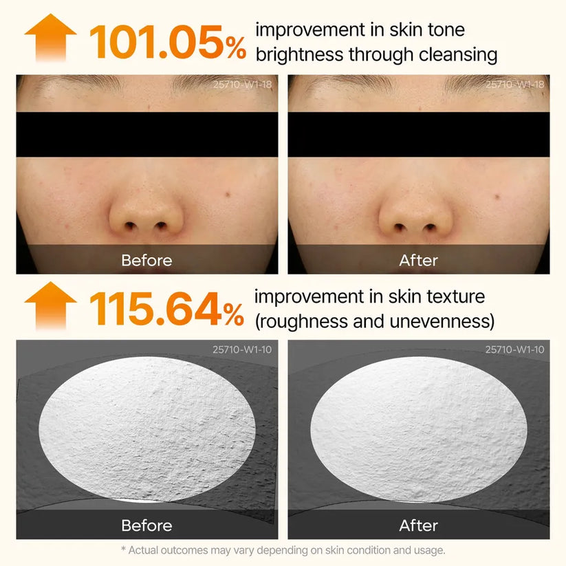 Dr MELAXIN - Peel Shot Kojic Acid & Turmeric Facial Exfoliating Serum – 80ml