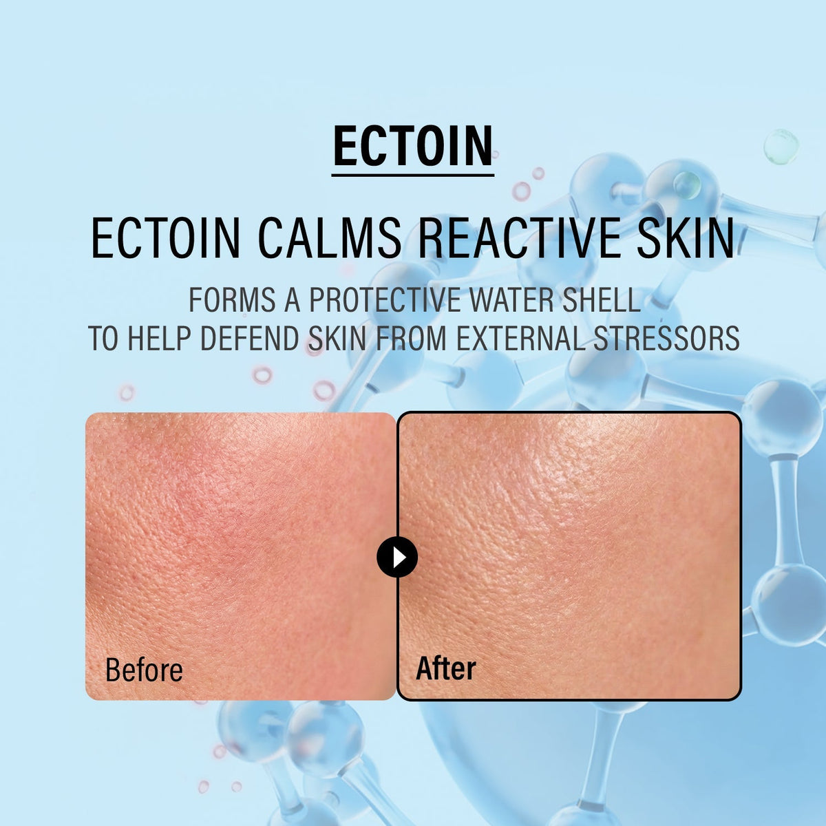 EPII - Double Up Cream ECTOIN & PANTHENOL -50ml