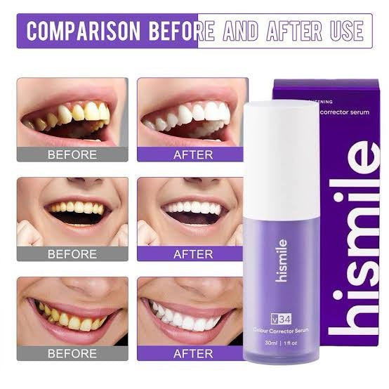 HISMILE - V34 Colour Corrector Serum - 30ml