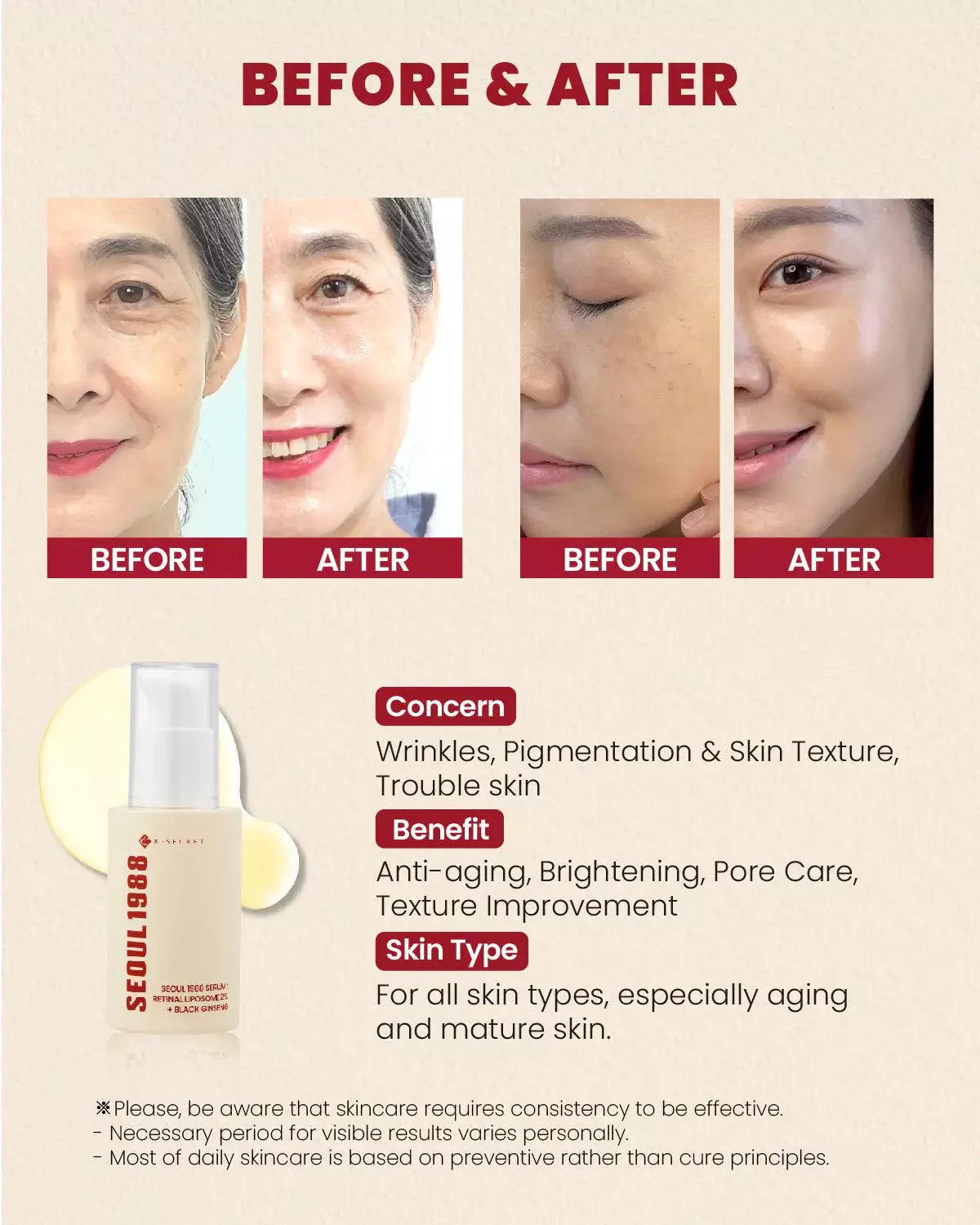KSECRET SEOUL 1988 - SEOUL 1988 Essence : Snail Mucin 97% + Riz-100ml