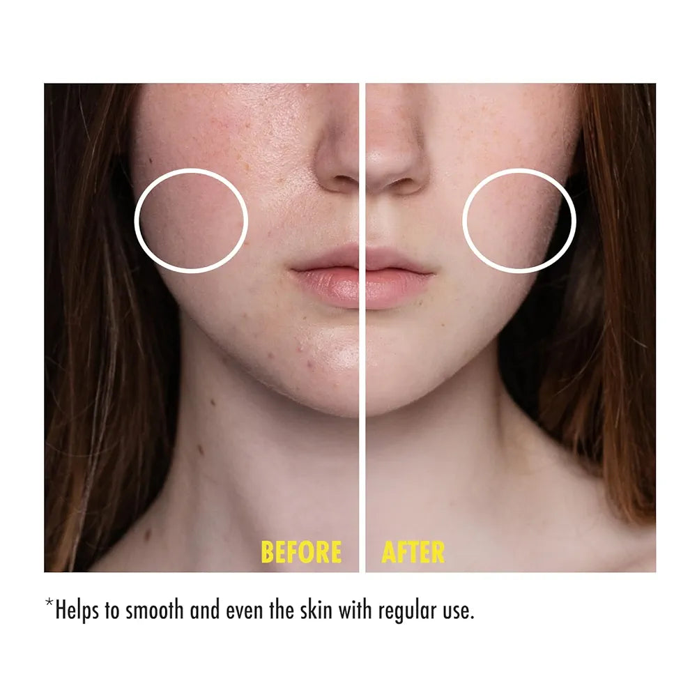 MARUDERM - Niacinamide Sérum Équilibrant 10% Sébum - 30ml