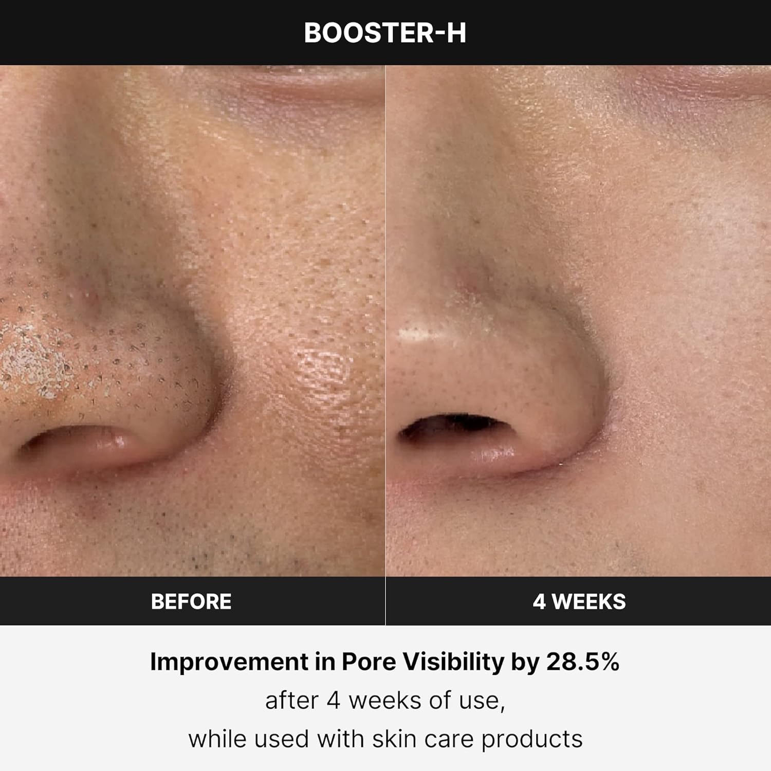 MEDICUBE - AGE-R Booster Pro - Appareil de Soin Visage