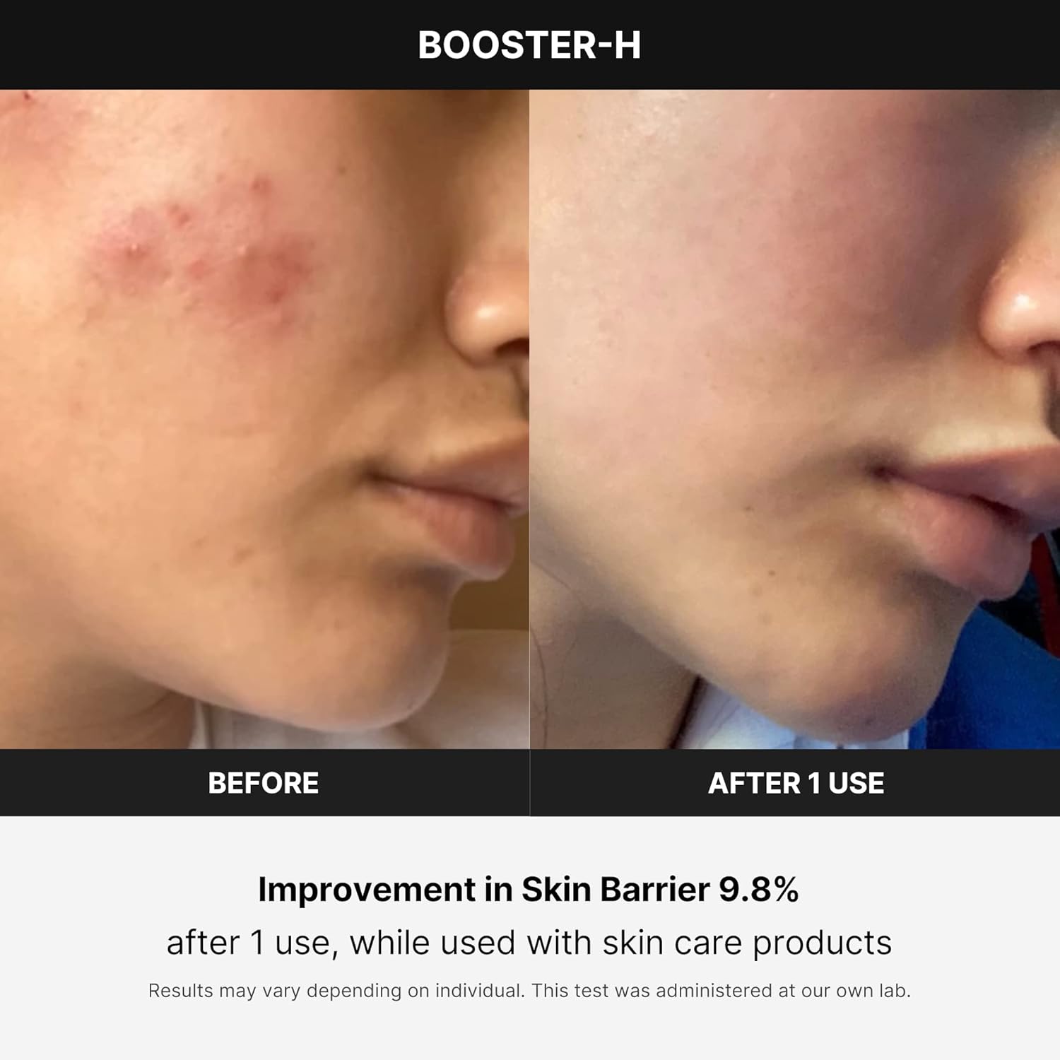 MEDICUBE - AGE-R Booster Pro - Appareil de Soin Visage
