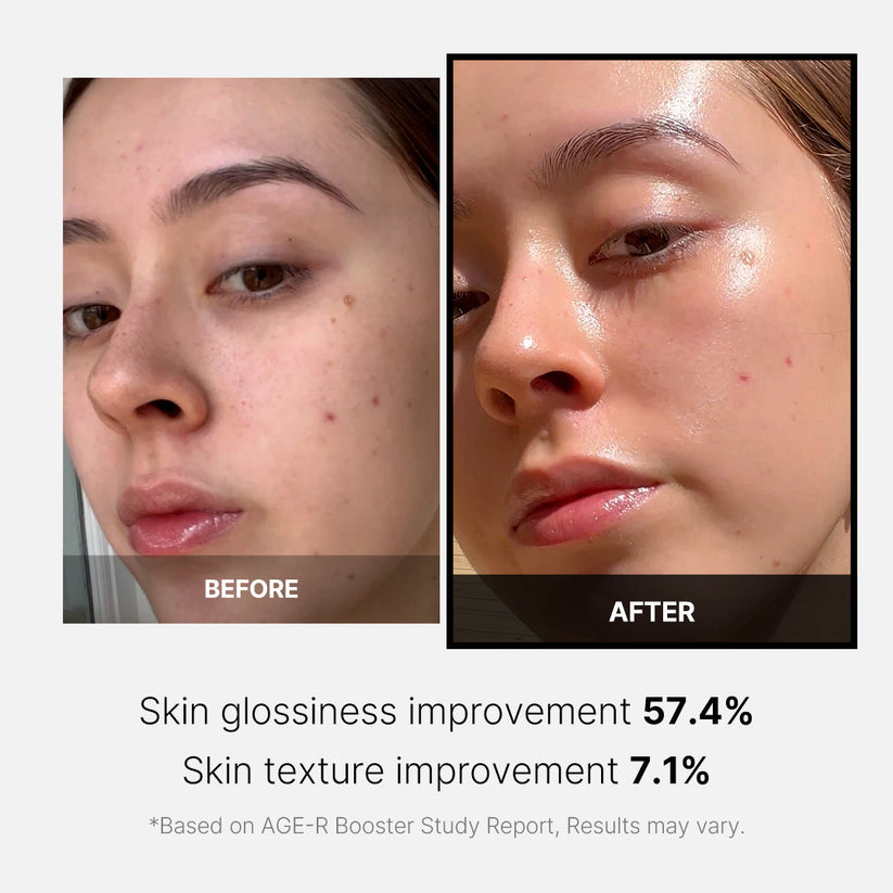 MEDICUBE - AGE-R Booster Pro - Appareil de Soin Visage