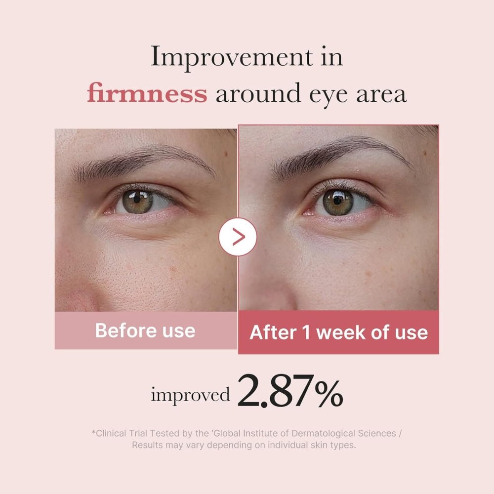 MEDICUBE - PDRN Pink Peptide Eye Cream - 30ml