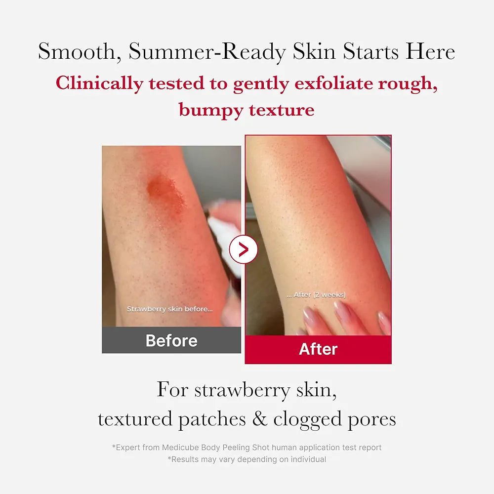 MEDICUBE - Red Acne Body Wash Off Peeling Shot - 110g