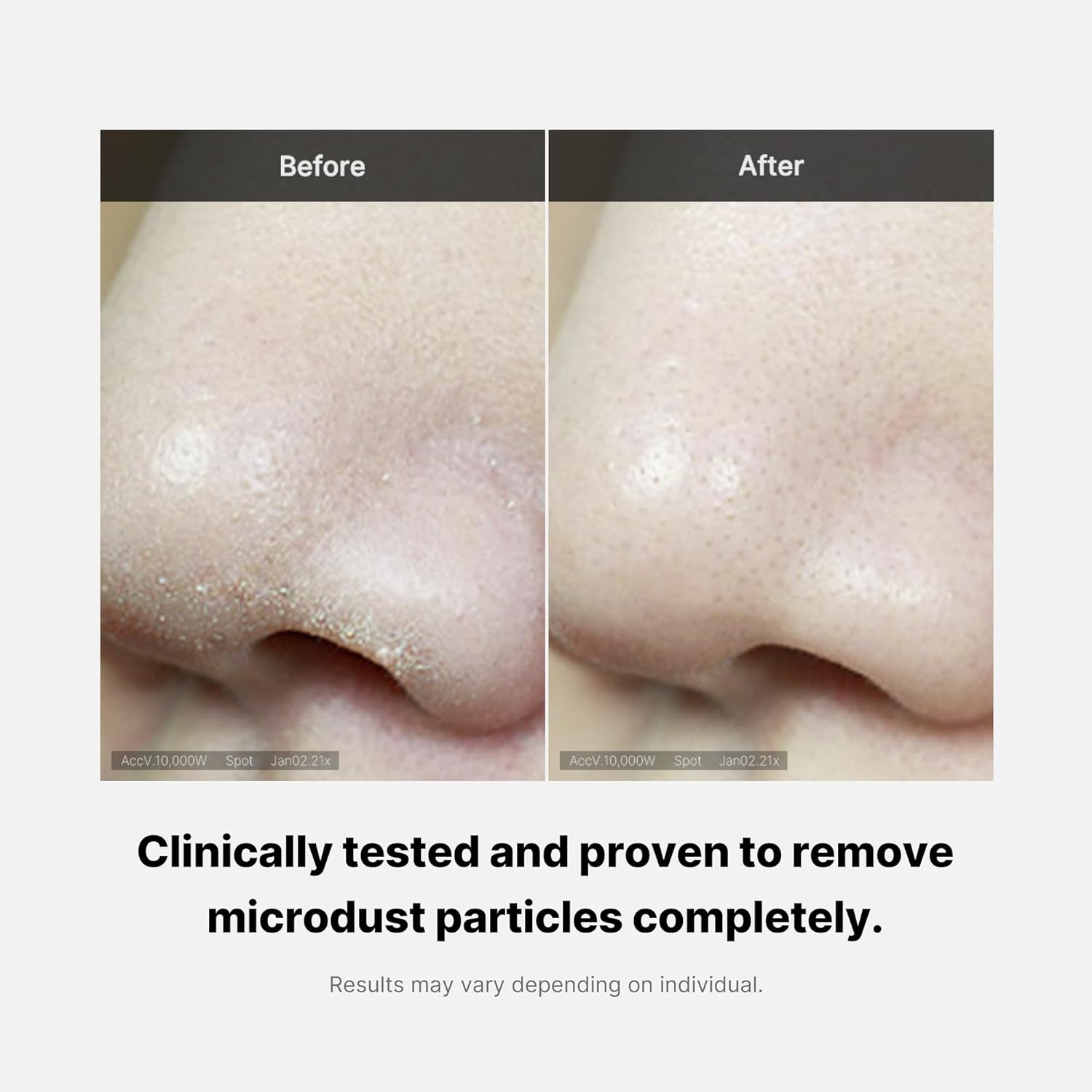 MEDICUBE - Zero Pore Foam Cleanser - 120g