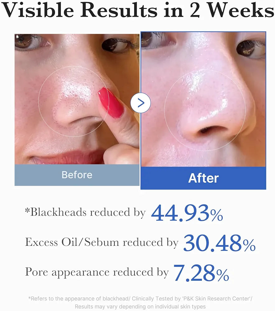 MEDICUBE - Zero Pore Pad 2.0 - 70 pads