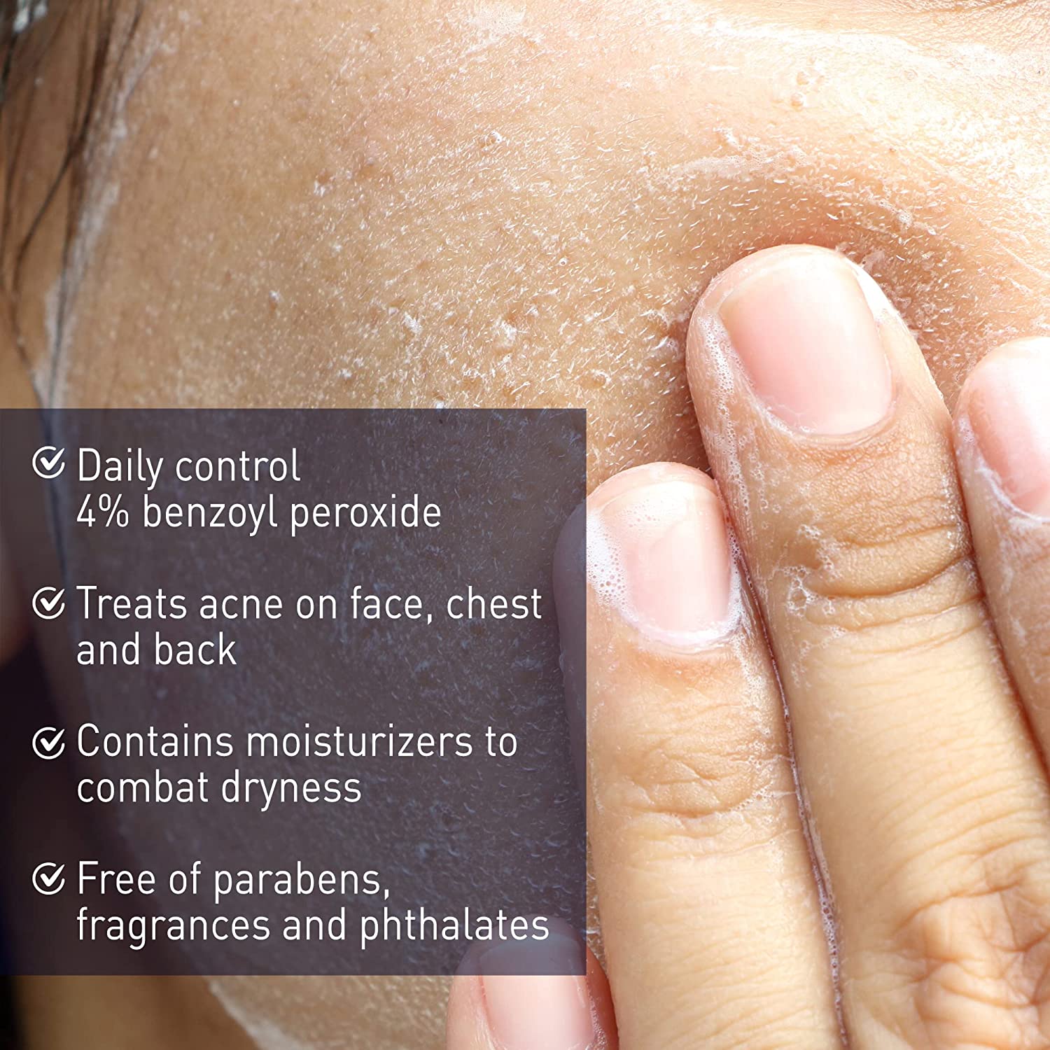 copy-panoxyl-acne-foaming-wash-benzoyl-peroxide-4