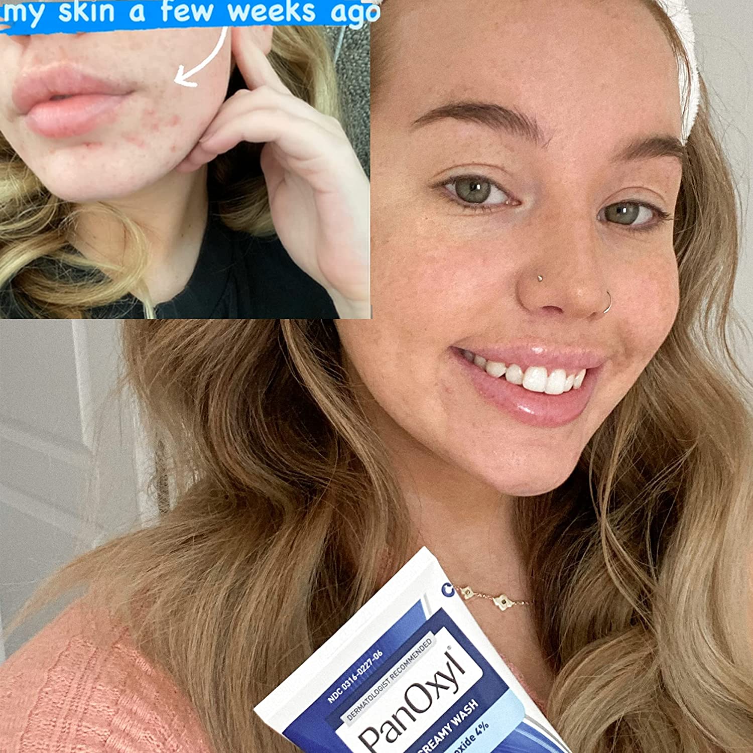 copy-panoxyl-acne-foaming-wash-benzoyl-peroxide-4