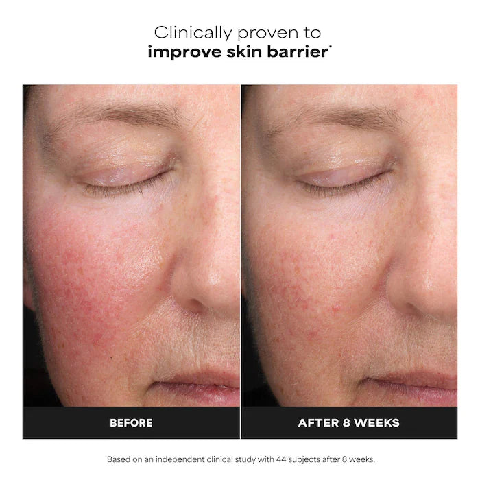 PAULA'S CHOICE - MINI Skin Perfecting 6% Mandelic Acid - 30ml
