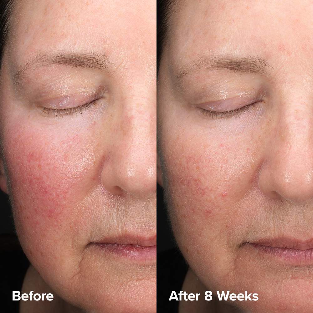 PAULA'S CHOICE - Skin Perfecting 6% Mandelic Acid + 2% Lactic Acid Liquid Exfoliant - 88ml