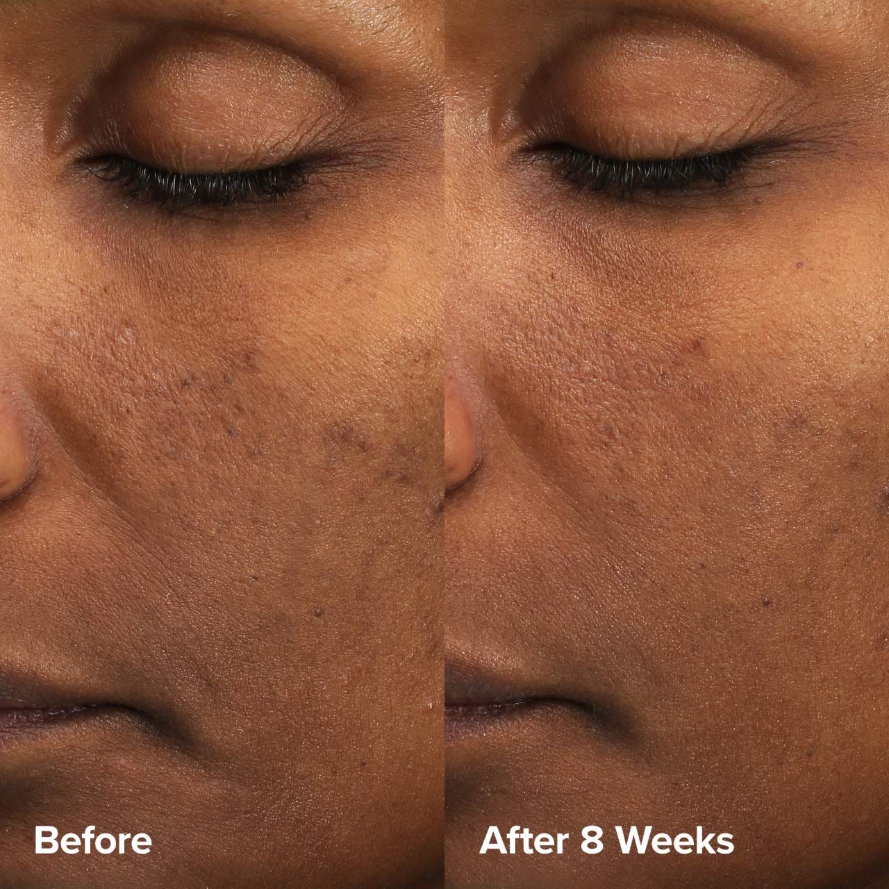 PAULA'S CHOICE - Skin Perfecting 6% Mandelic Acid + 2% Lactic Acid Liquid Exfoliant - 88ml