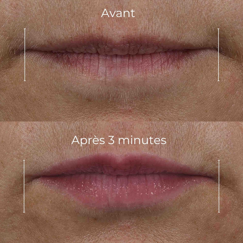 RoC - Derm Correxion Lip Volumizer Soin Volumateur lèvres - 10ml