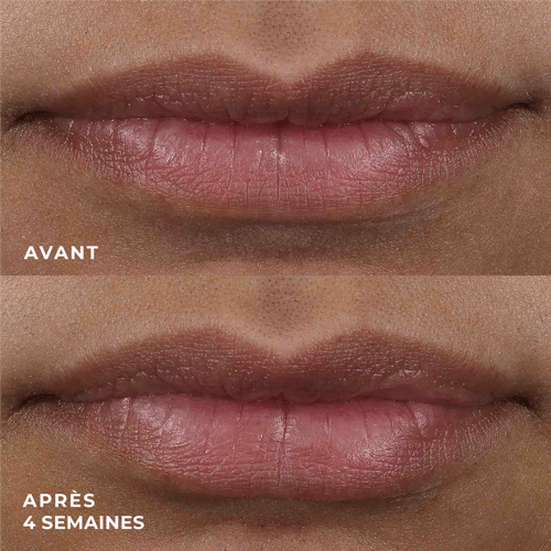 RoC - Derm Correxion Lip Volumizer Soin Volumateur lèvres - 10ml