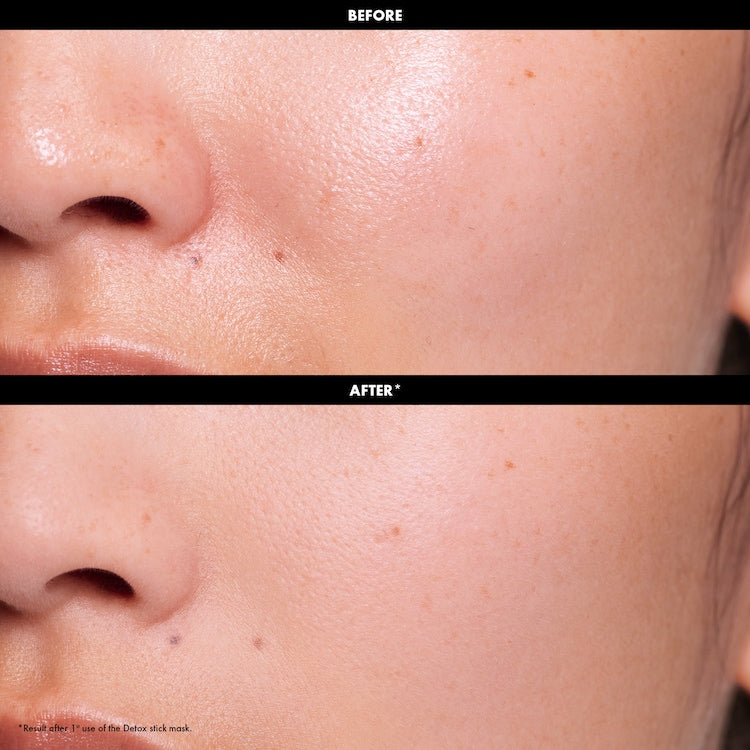 SEPHORA - Masques en stick Détox ou Éclat - 15g