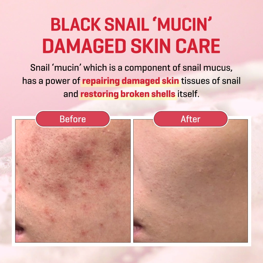 SOME BY MI - SNAIL TRUECICA MIRACLE REPAIR CREAM - 50ml