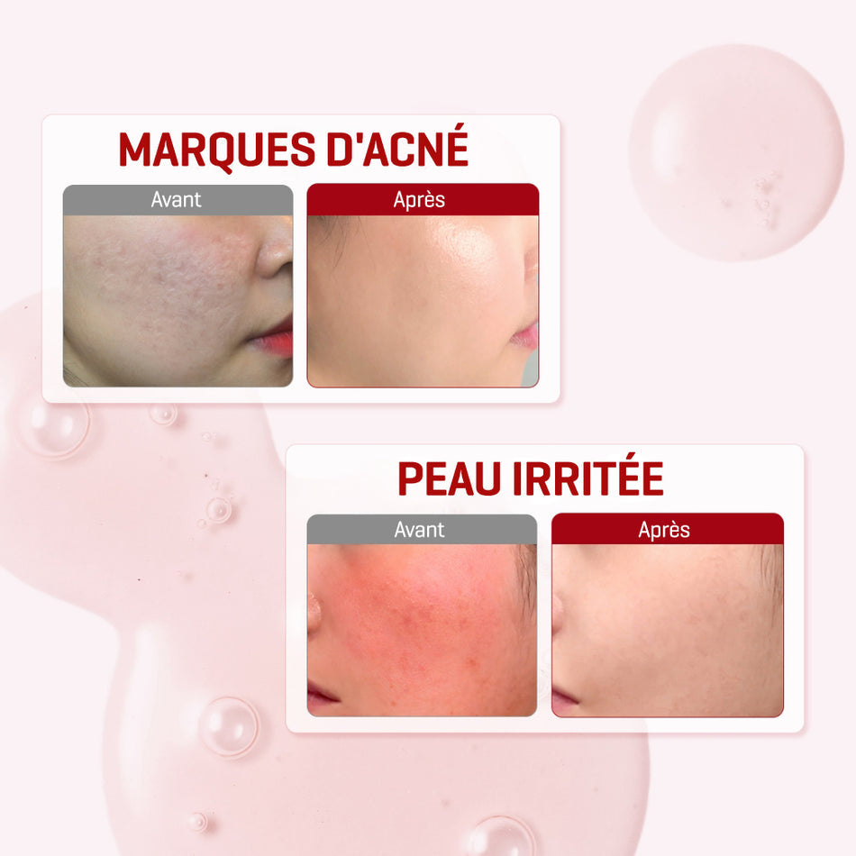 SOME BY MI - SNAIL TRUECICA MIRACLE REPAIR SERUM - 50ml