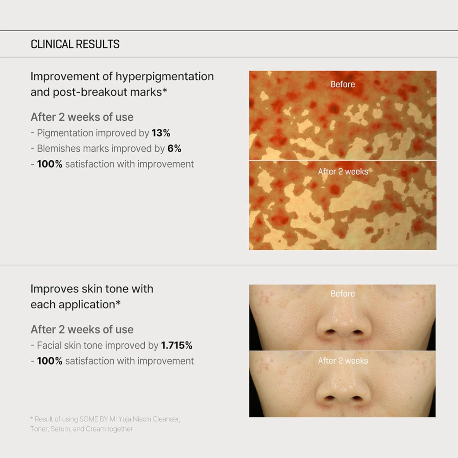 SOME BY MI - YUJA Niacin Anti-Blemish Cream - 60g