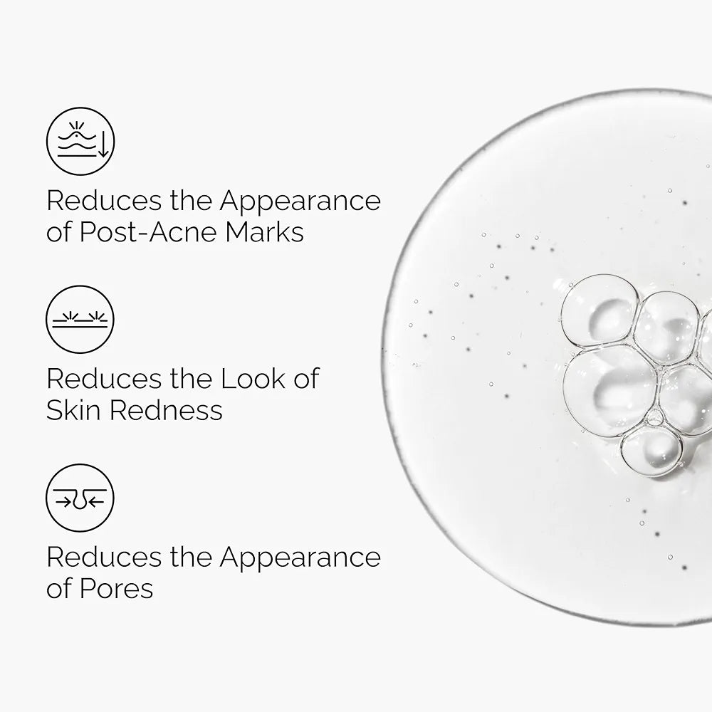 THE ORDINARY - Aloe 2% + NAG 2% Solution- 30ml