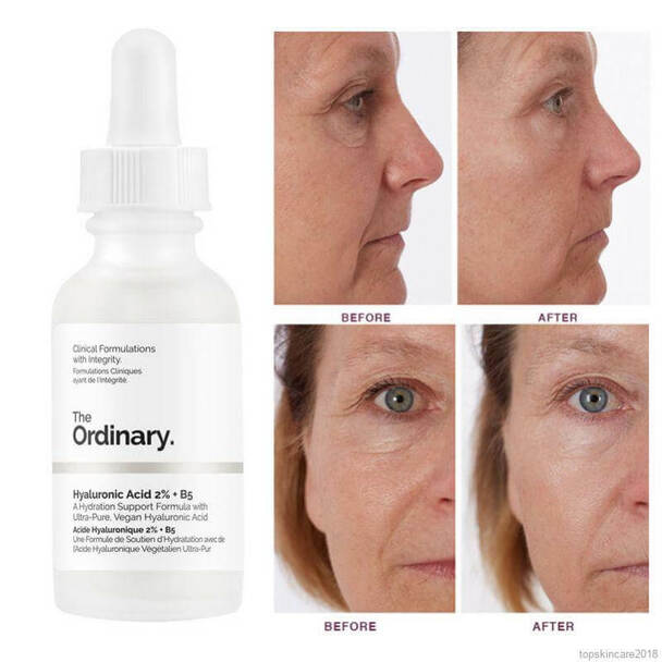 the-ordinary-hyaluronic-acid-2-b5-full-size-60ml
