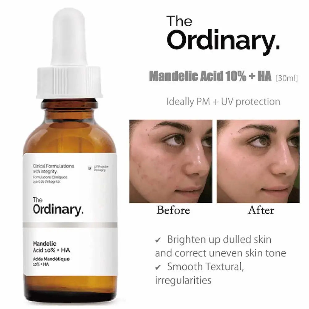 the-ordinary-mandelic-acid-10-ha