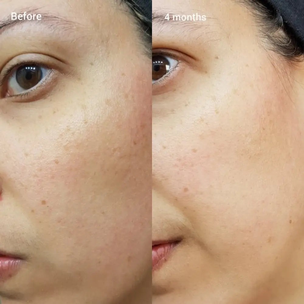 the-ordinary-retinol-1-in-squalane-30ml