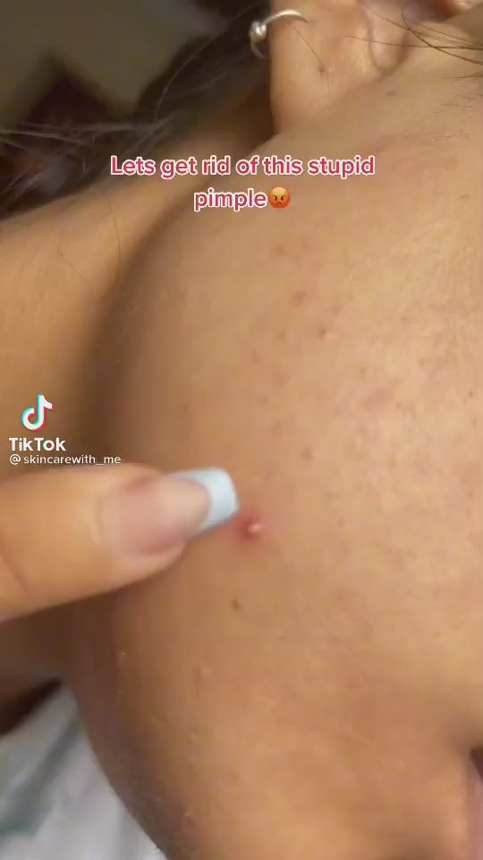 Charger la vidéo : COSRX - Acne Pimple Master Patch - 24 Patchs